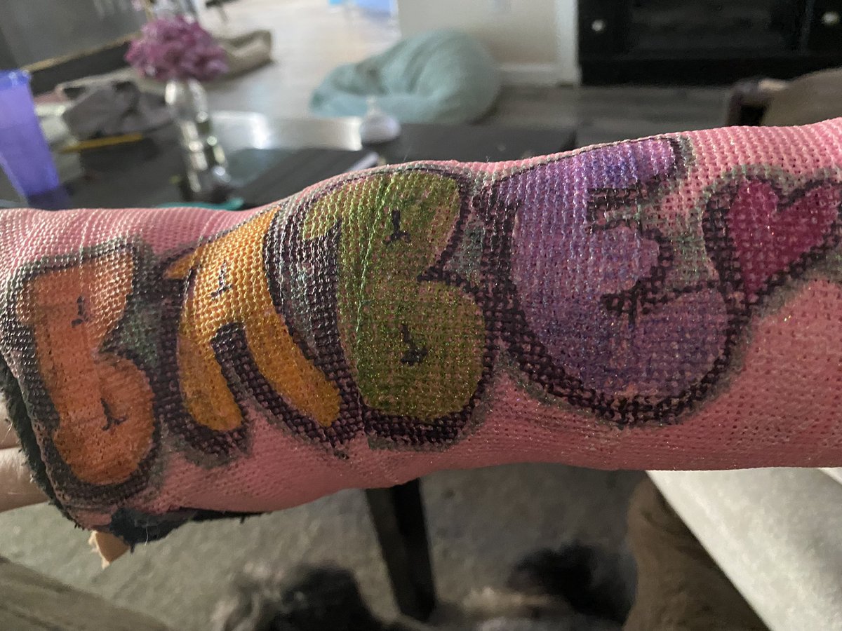 hellaphotogenic's tweet image. Cast comes off tomorrow!!!!!