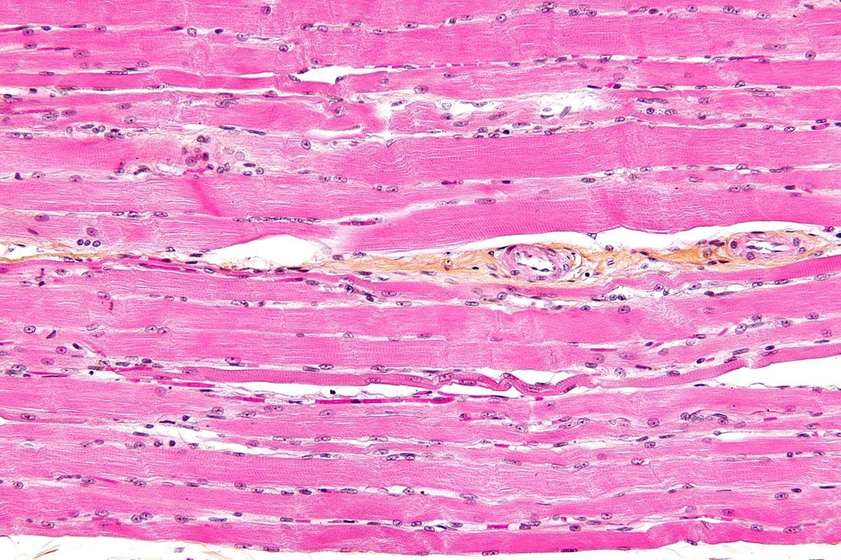 Join our lab to investigate how evolution has come up with solutions to enhance and maintain muscle function. A fully-funded #PhD at the University of Exeter's Cornwall campus. Deadline for applications this Friday (24th June 2022) exeter.ac.uk/study/funding/… <a href="/UniExeCEC/">University of Exeter CEC</a>