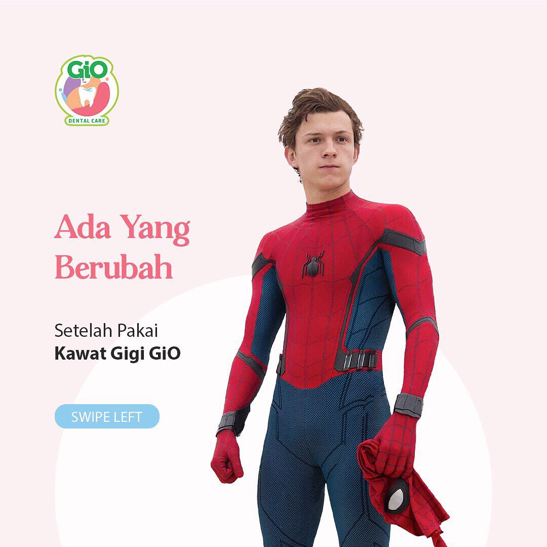 GiODentalCare's tweet photo. Gigi berubah jadi Rapi dan Sehat, bikin senyum makin sumringah ya Sayang GiO🥰
Kawat Gigi GiO solusinya
✨Ditangani Team Dokter dengan budaya JITU
✨Pilihan jenis Kawat Gigi lengkap
✨Perawatan Optimal &amp; terencana
✨Biaya terjangkau

Cus ke GiO sekarang🥰
#giokawatgigi #SayangGiO https://t.co/a6lgtA71qj