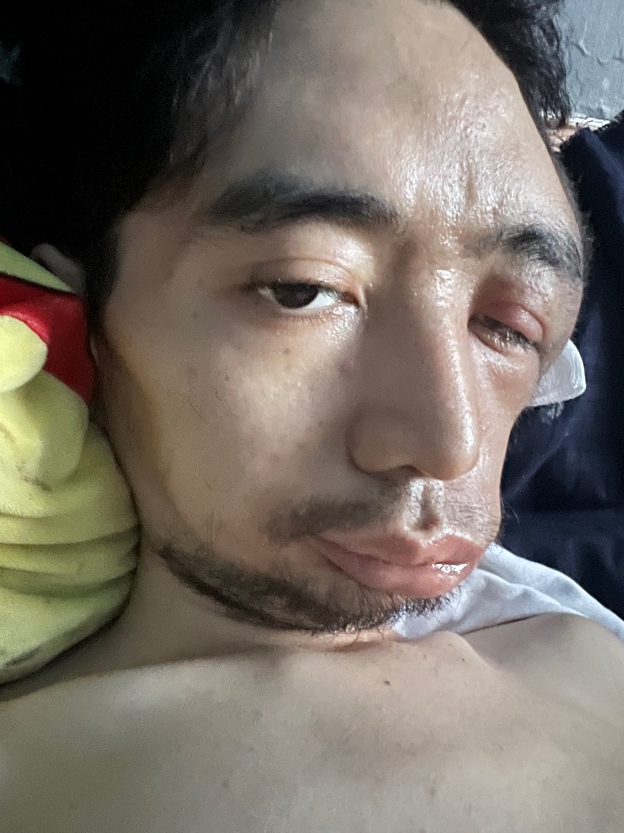 AnnoyNemous's tweet photo. hihingi po sana ng tulong pambili ng ngt food. hirap na po kumain after stroke. laban pa din po  tayo. hanggat kaya. 

Gcash 0969 326 3244 https://t.co/fGwqRBYwVV