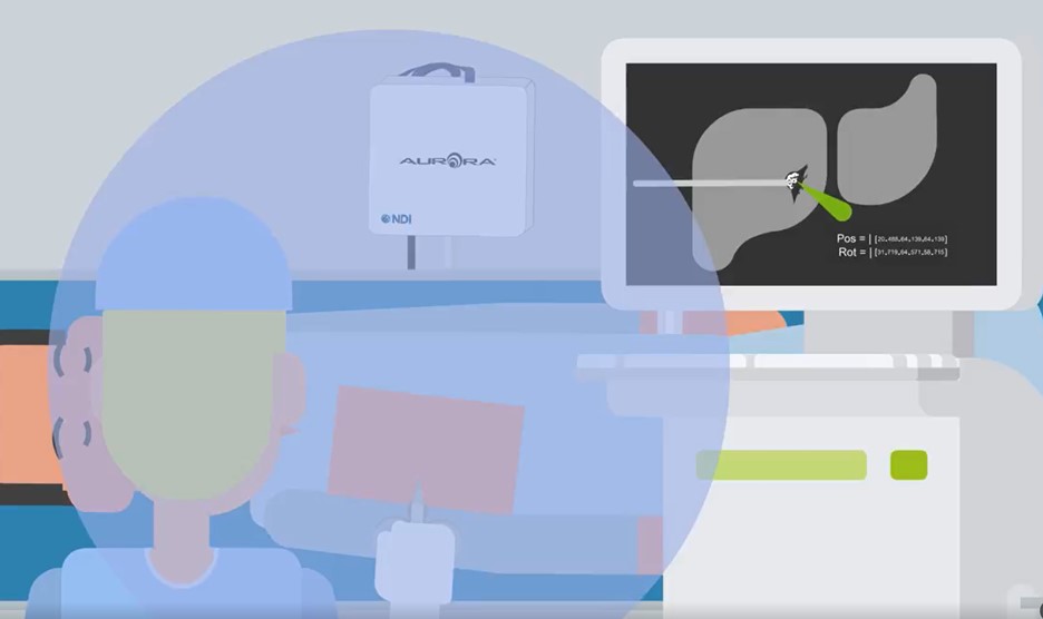 How does NDI's electromagnetic navigation technology work? Check out this informative video from our colleagues in NDI Europe. 

ow.ly/ybm450JAsCQ

#innovation #technology #medtech #navigation