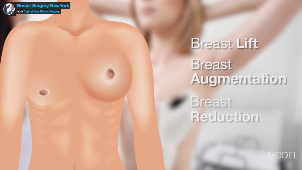 CapsnyCosmetic's tweet photo. Care Instructions After Breast Surgery - https://t.co/MDOdqea8FE https://t.co/ygE6DQ4KPr