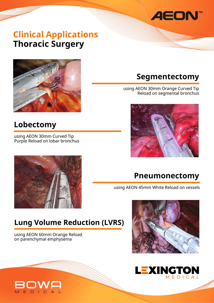 BOWAMEDICALUK's tweet photo. Clinical Applications in Thoracic Surgery

Surgeons worldwide choose the #AEONEndostapler to perform complex procedures in #ThoracicSurgery owing to AEON's unique S3 Engineering™ features:

- SUPERIOR STAPLE LINES
- SMOOTH ARTICULATION
- MULTI-SPEED GEAR https://t.co/UrKktieGj2