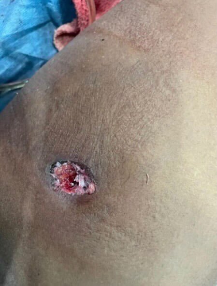BriellaNeme's tweet photo. @okah_dorcas @DavidHundeyin @burnaboy You want proof! These are just two bruises on my body, my partners head after he got stitches and the gunshot wound to his friends thighs. https://t.co/7Vc2BhCxDk