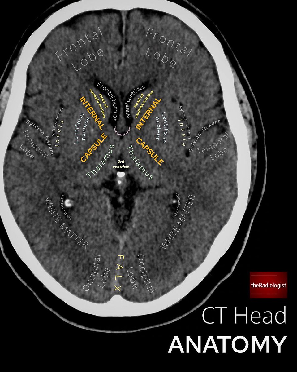 Oren Gottfried, MD tweet media