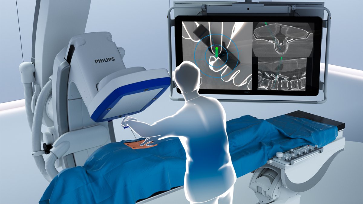Sticky_Lock's tweet photo. The FDA has approved an #AR solution to simplify navigation during spine surgery 🦴

Physicians can now utilise operational guidance systems to help them gain greater familiarity with the anatomy of patients. 🩺🧬

Read the whole article here👉https://t.co/gKl7dZwkTs

#Blog https://t.co/qa2LrlznN1