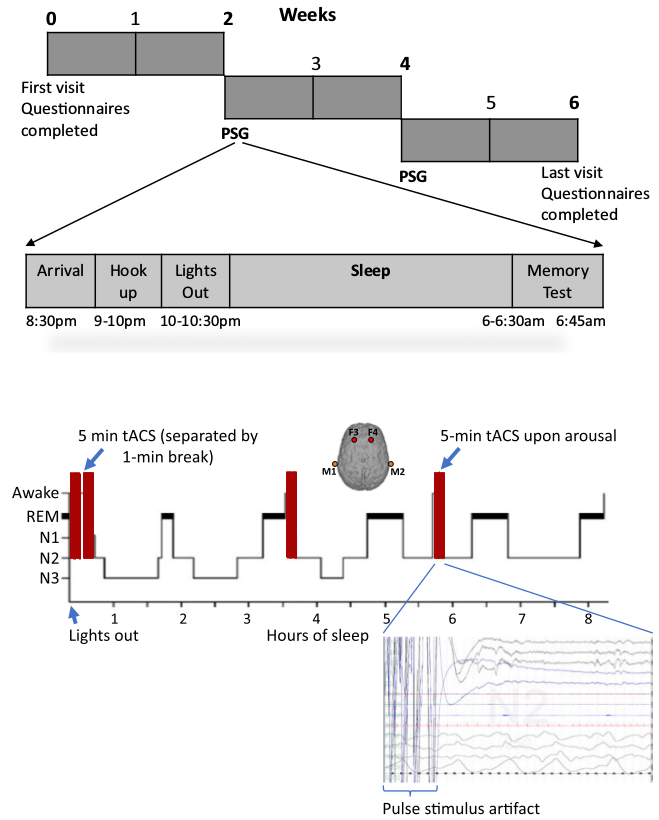 SoterixMedical's tweet photo. Image shows visits,timing, & stim paradigm. Set-up was customized with long cables for remote trigger & custom electrodes to:a) maintain adequate contact impedance for overnight stim and b) reduce scalp pressure/discomfort due to electrode holder https://t.co/2Y5LqK04F0 #HDtACS https://t.co/Ai4NPIuUwG