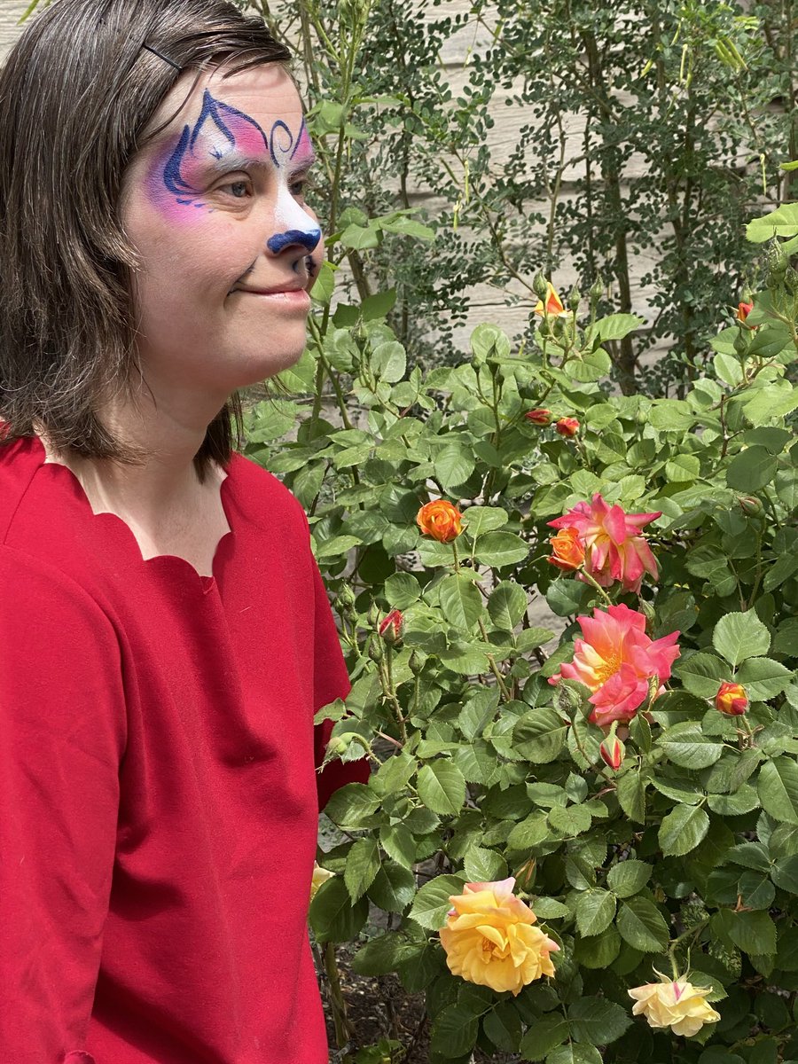 AgainShauna's tweet photo. @syndrome22q1 #YoJustin You make ME smile. I am glad to know you. My daughter Beth has a disability- Down Syndrome. She makes me smile too. https://t.co/7WzNsCxqPa