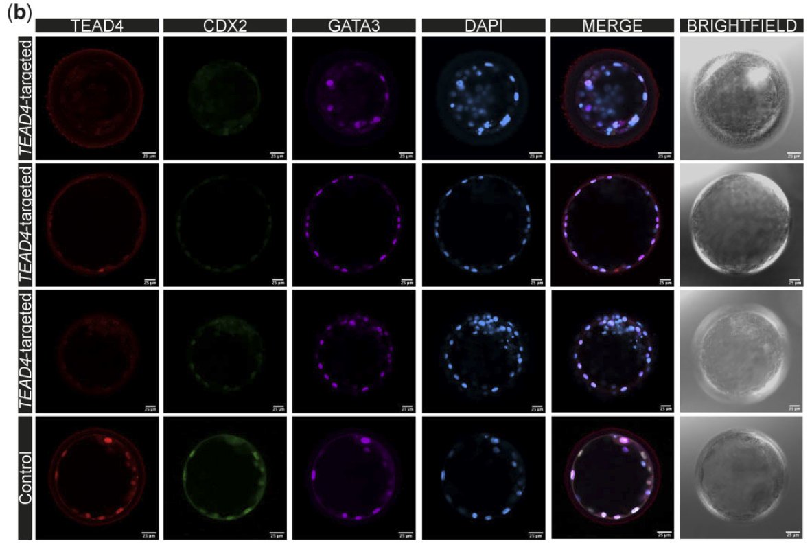 PhD_bruneau's tweet photo. A novel CRISPR/Knock-out experiment in the human embryo by Stamatiadis and colleagues.

TEAD4 regulates trophectoderm differentiation upstream of CDX2 in a GATA3-independent manner in the human preimplantation embryo https://t.co/2coycKcsq7 https://t.co/WgHBUbBCHT