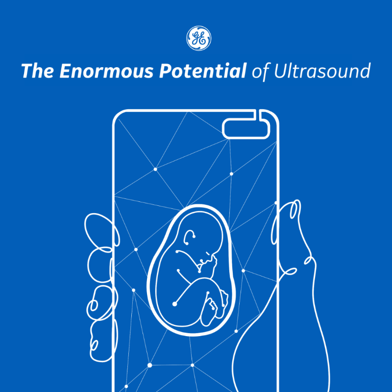 GEHealthCare's tweet photo. Acquiring @BK_Medical, partnering with @Pulsenmore and launching @Vscan Air have been a few pivotal moments in @GEHealthcare's #ultrasound history. All of these efforts have helped to provide doctors with an extra set of "eyes", helping to create better #patientsoutcomes.