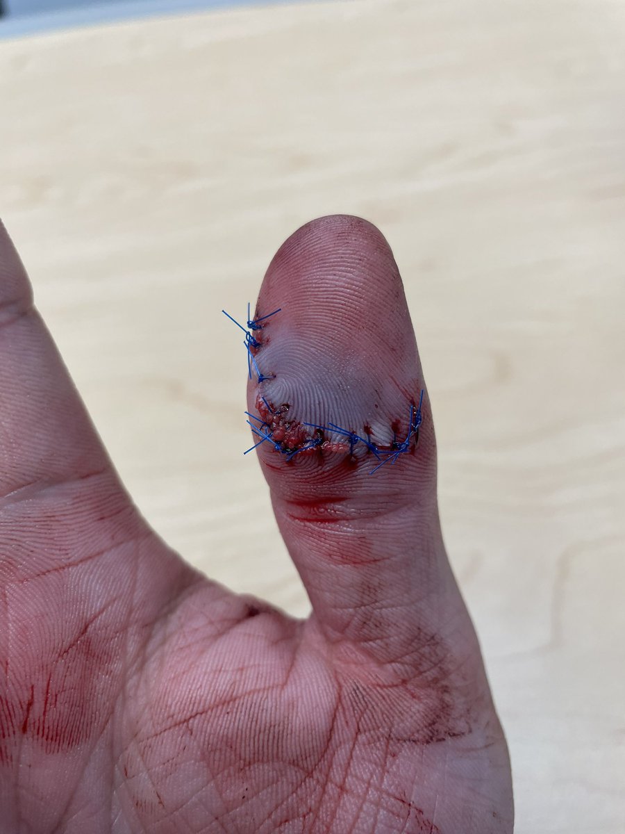 alexwesley81's tweet photo. Well this had to happen on Father’s Day yesterday. Man this shit hurts. https://t.co/ACjeJEuwKf