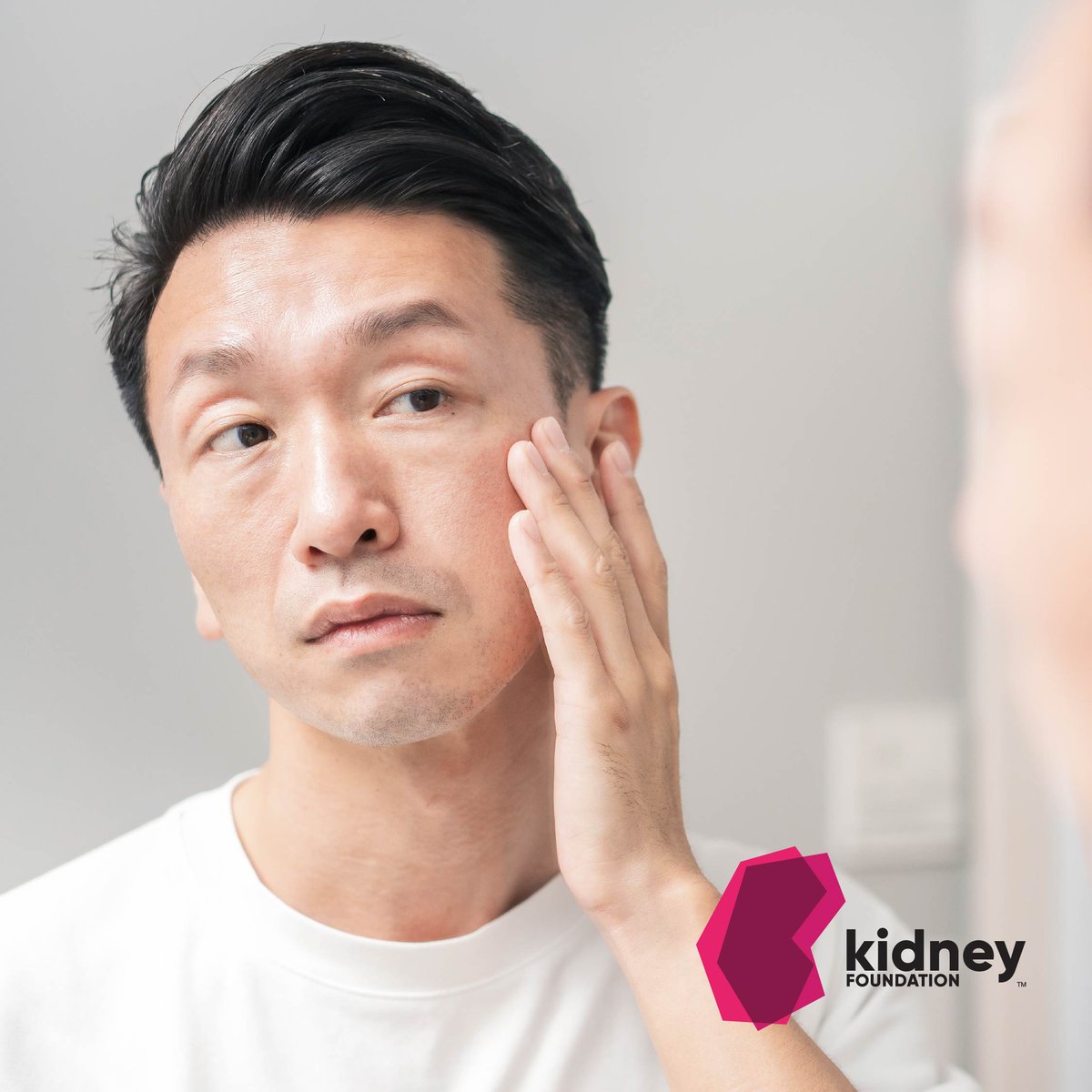 Our next webinar “Body Image and Self-Esteem” will be held on June 28 and will empower you to think about #BodyImage in a new light. The topics include stretch marks, hair and weight changes from treatments; dialysis; dating with CKD, and more. Register: us06web.zoom.us/webinar/regist…