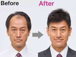 男版が無いとか言ってる人居るから
貼っといてあげるよ
ヘアスタイルの大事さ  