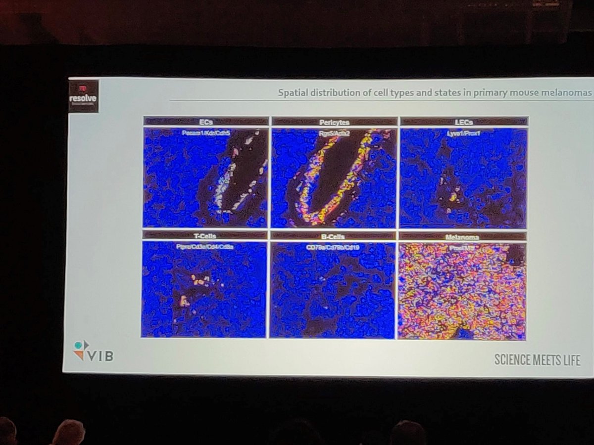 ResolveBioSci's tweet photo. At #agbt22, Panagiotis Karras from @vib_ccb @lab_marine gave a fantastic talk on understanding the #melanoma spatial transcriptional landscape and pinpointed the cellular interactions of the TIME in #singlecell resolution using Molecular Cartography. https://t.co/dLg53dYKg5