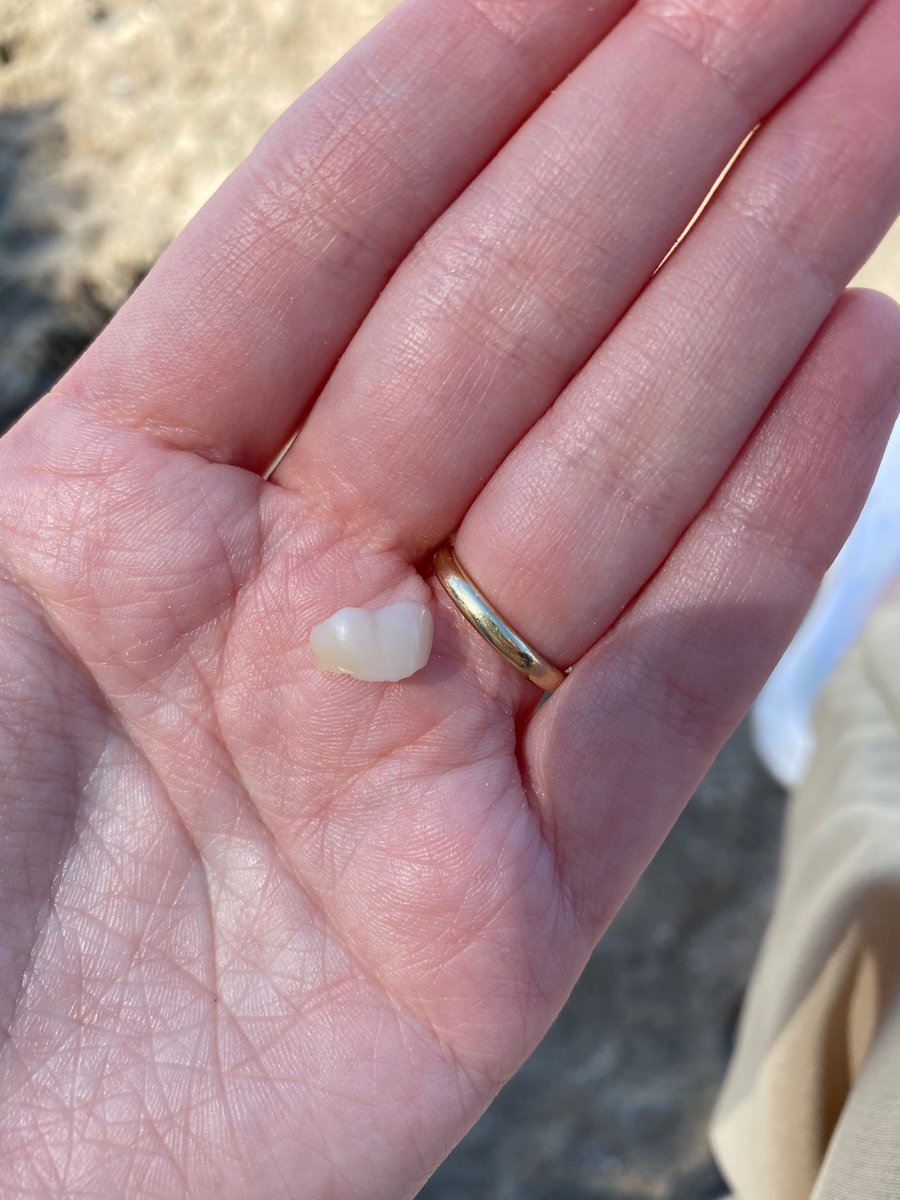 Það er lögmál lífsins að um leið og maður verður að spara þá fer tanngarðurinn að hrekkja veskið.