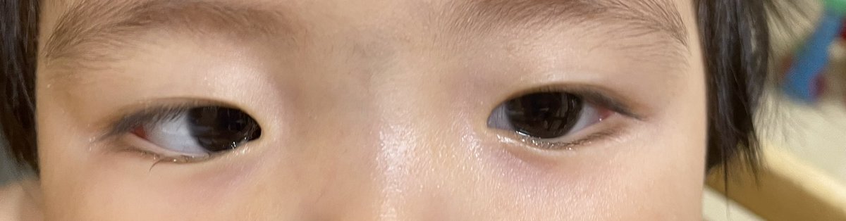 mamanonkidane's tweet photo. 今日の次女の目。
毎朝一重。 https://t.co/qNCep4frz0