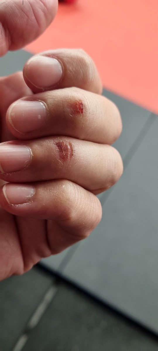 Marama's tweet photo. @hellomotorbike I took up Brazilian Jiu Jitsu, love it. I now have had like this from griping on for dear life 🤦🏽‍♀️🤣 https://t.co/xXlV486qjo