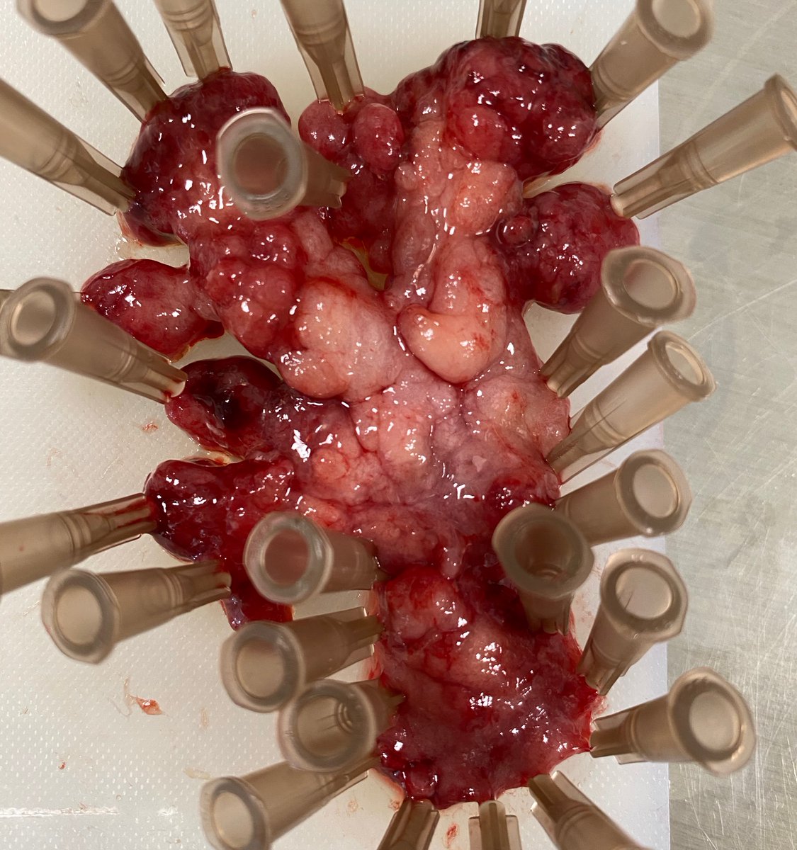 Something to go with your morning ☕️? Let us know (comment) the ➡️predicted histology and ➡️which part of the GI tract we removed it from for a chance to win a 🔥free🔥 GIEQs 3 (ow.ly/ck3Q50JCcMo) registration. #endoscopy #gitwitter #everydayEndoscopy (first response wins)
