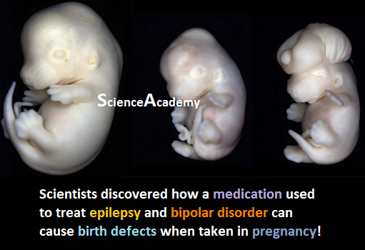 Academ18Academy's tweet photo. Scientists discovered how a #medication used to treat #epilepsy and #bipolardisorder can cause #birthdefects when taken in #pregnancy! #ScienceAcademy https://t.co/tJPBsVoKPL https://t.co/Zo0kSGfj8l