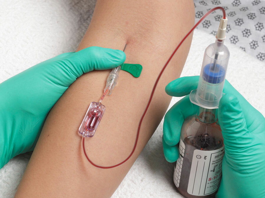 You’re an intern called to see a patient who is febrile to 38.5.

They are day 1 post an uncomplicated elective hemicolectomy.

Would you send blood cultures? Open this thread and I’ll share my approach.

#ChoosingWisely
#MedEd #Tweetorial
#MedTwitter #MedStudentTwitter
