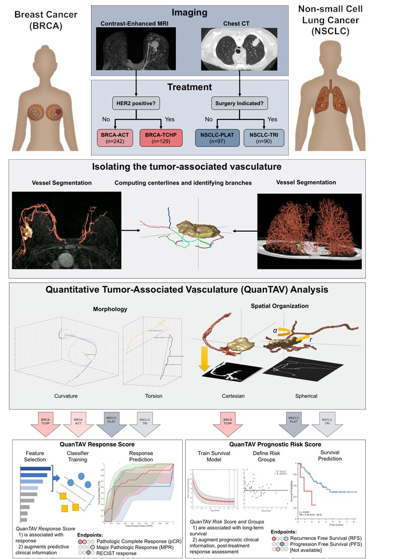 Anant Madabhushi (@anantm) on Twitter photo Thrilled to report new paper "Novel Radiomic Measurements of Tumor-Associated Vasculature (TAV) Morphology on Clinical Imaging as a Biomarker of Treatment Response in Multiple Cancers" in <a href="/CCR_AACR/">Clinical Cancer Research</a>, led by Dr <a href="/nathanielbraman/">Nathaniel Braman, PhD</a>. TAV predicts chemo response in breast & lung cancer. Thrilled to report new paper "Novel Radiomic Measurements of Tumor-Associated Vasculature (TAV) Morphology on Clinical Imaging as a Biomarker of Treatment Response in Multiple Cancers" in <a href="/CCR_AACR/">Clinical Cancer Research</a>, led by Dr <a href="/nathanielbraman/">Nathaniel Braman, PhD</a>. TAV predicts chemo response in breast & lung cancer.