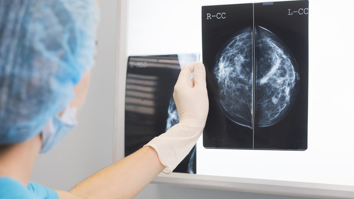2 separate studies for colon cancer/breast cancer show promise that some patients may be able to forego chemotherapy and radiation after surgery.  This would lead to a less invasive, more comfortable recovery. #cancertreatment #coloncancer #breastcancer 
conta.cc/3Hm9Syu