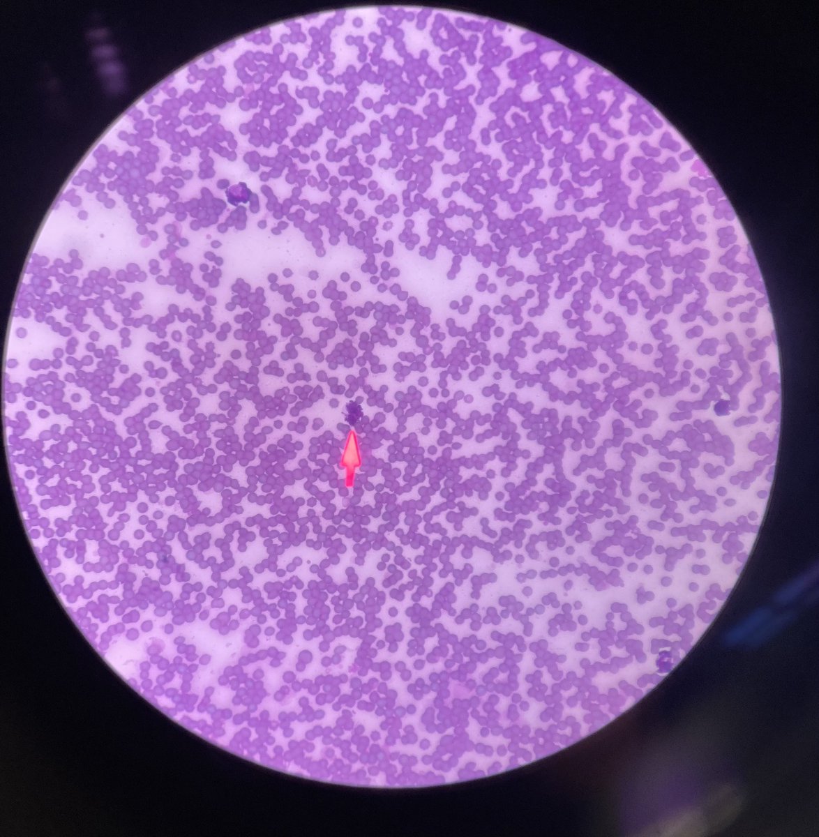 BoilerVetCamp's tweet photo. Guess what we did today? We found a leukocyte in a blood smear! #TeamMadMax https://t.co/qUnOxguTqd
