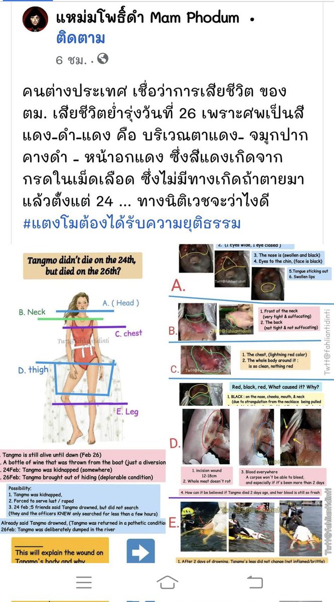 Cpgr79203's tweet photo. เเปะไว้  ขาน้องมีตะปู  ตอนเจอศพ ข้อเท้ามีรูเชือกลาก  เลือดยังไหล  แผลใหม่แบบมีดกรีด  มีรอยตาข่ายแผลเป็นบั้ง  หน้าตาปูด  ในท้องไม่มีอาหาร แสดงว่าย่อยไปละ มีแต่ดินทราย  ศพไม่ลอย ตายผิด���รรมชาติ #เสือกเพื่อชาติ  #Saveอัจฉริยะ   #แตงโมต้องได้รับความยุติธรรม https://t.co/gBJLLcyoEw
