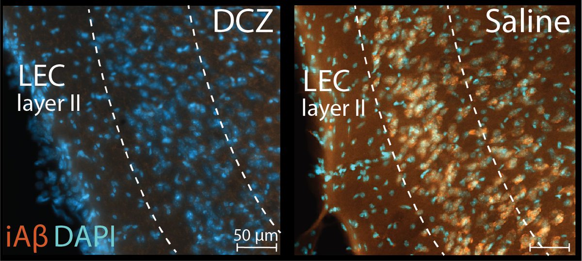 Christiana Bjorkli, PhD (@theinsideoutof1) on Twitter photo Interested in how neuronal silencing of LEC layer II neurons affects early appearing Aβ in a circuit necessary for processing contextual memory?🧠
Check out our preprint👉biorxiv.org/content/10.110…
Nora Ebbesen, Joshua Julian, @Mennopw, Axel & Ioanna Sandvig Interested in how neuronal silencing of LEC layer II neurons affects early appearing Aβ in a circuit necessary for processing contextual memory?🧠
Check out our preprint👉biorxiv.org/content/10.110…
Nora Ebbesen, Joshua Julian, @Mennopw, Axel & Ioanna Sandvig