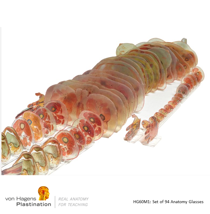 vonHagensPlast's tweet image. Anatomy Glass (HG) provides detailed #cross-sectional views of the human body. Available individually, as region-based sets, or as a whole body. Captivating and durable. Available to anyone, for use anywhere.​

Anatomy accessible to all with von Hagens Plastination.