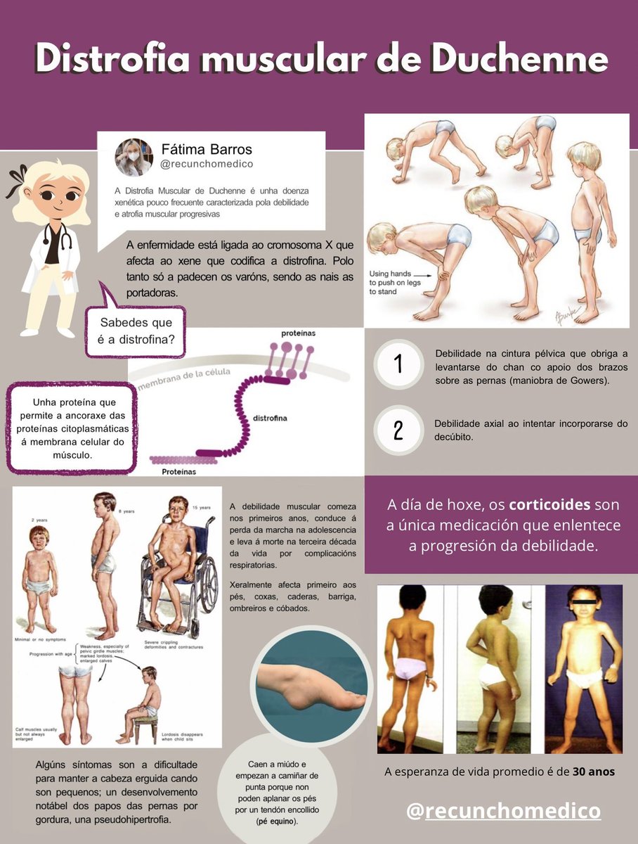 Como vos prometín… un póster exprés sobre a Distrofia Muscular de Duchenne  🩺🧑🏻‍🦽 Agardo que vos resulte útil! 

#distrofiamuscular #enfermedadesraras #duchenne #divulgacionmedica