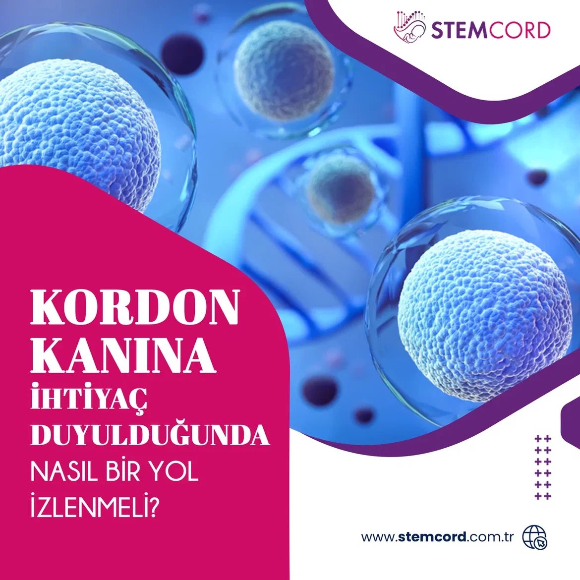 Kordon kanından elde edilen hematopoietik (kan yapıcı) kök hücreye ihtiyaç duyulduğu takdirde ilk yapılması gereken, STEMCORD yetkilileri ile temasa geçmektir. Bu şekilde, oluşan durum hakkında sizden detaylı bilgi alabilir ve tüm gerekli hazırlıklara başlayabiliriz. ✅
#stemcord