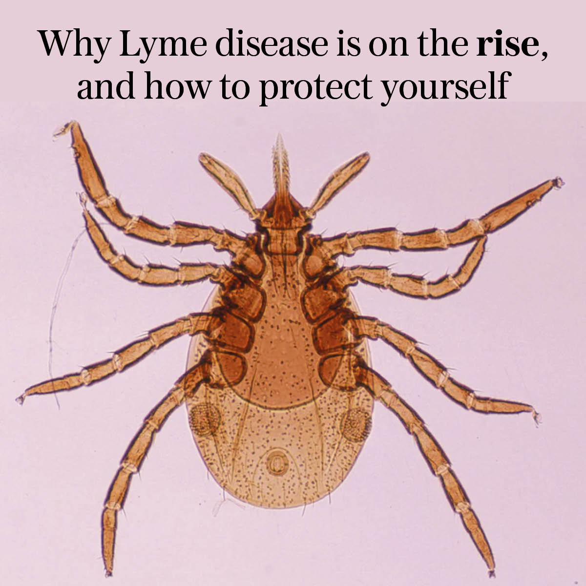 ❓Why Lyme disease is on the rise – and how to protect yourself

If you think you’ve been bitten by an infected tick while enjoying a summer’s day, you must act swiftly

Thread 🧵👇
telegraph.co.uk/health-fitness…
