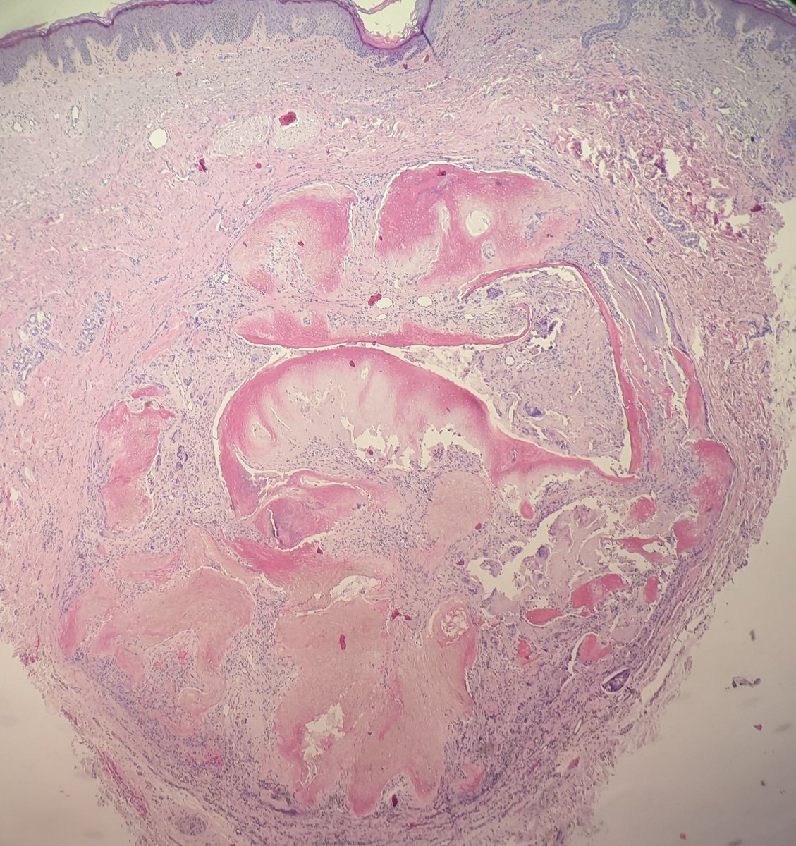 Here's a #pathspotter from my first day of #dermpath rotation! @PathSpotters