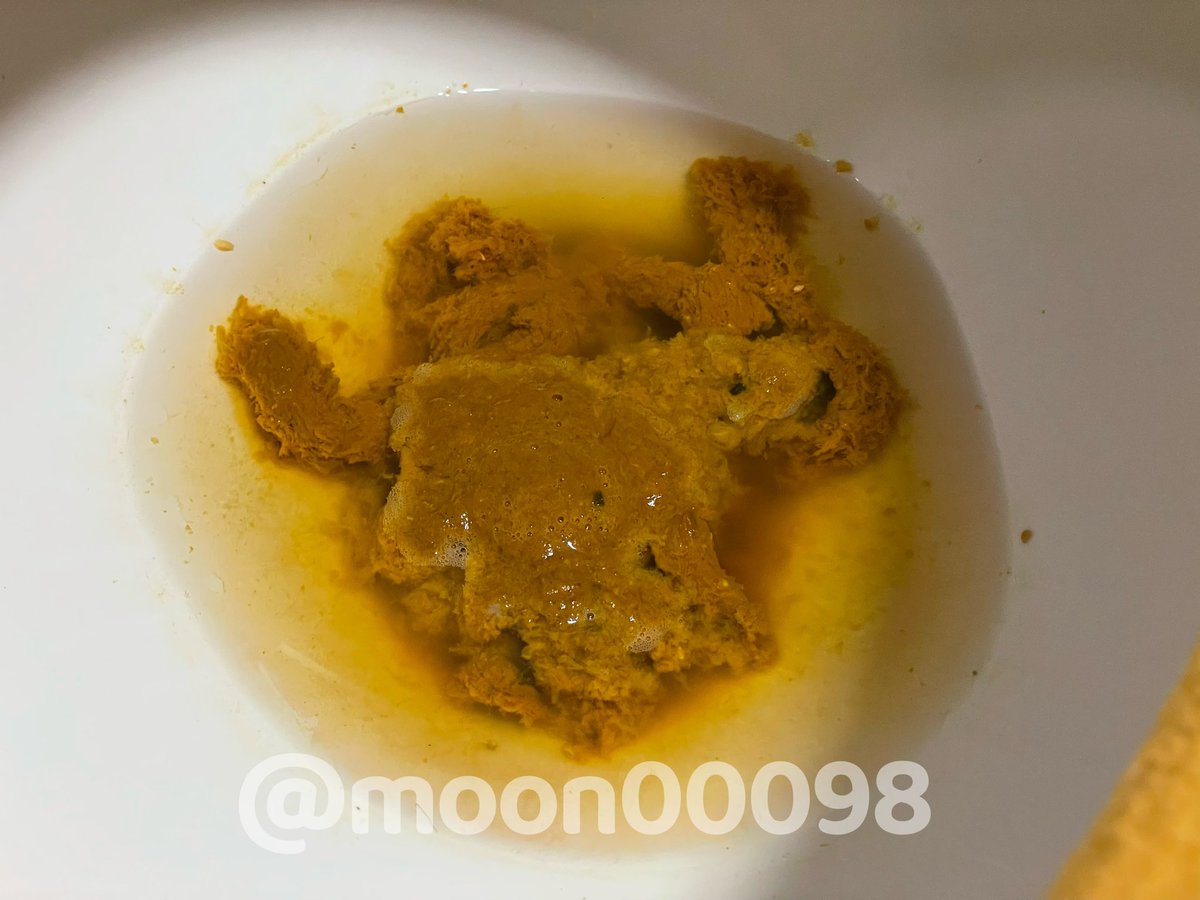 moon00098's tweet photo. 又拉肚子了🥲🥲

#黄金 #排泄 https://t.co/CHBqc5cmIo