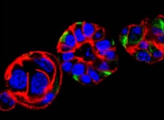 In case you missed our latest @nature! We discovered how #Grem1 and #Bmp2 regulate epithelial-to-mesenchymal transition (#EMT) and #metastasis in #PDAC.
We hope understanding #TumourHeterogeneity of #PancreaticCancer will help us beat this deadly disease🔬
nature.com/articles/s4158…