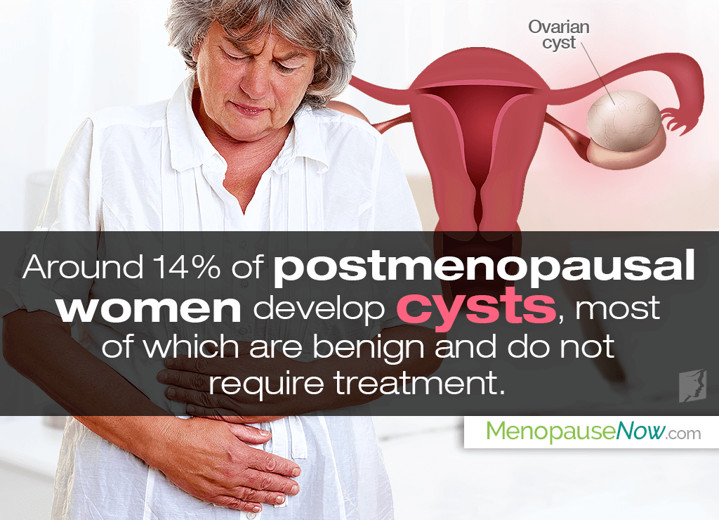 Learn more about ovarian cysts after menopause, including what causes them, are ovarian cysts common after menopause, and what symptoms they can produce. menopausenow.com/postmenopause/…