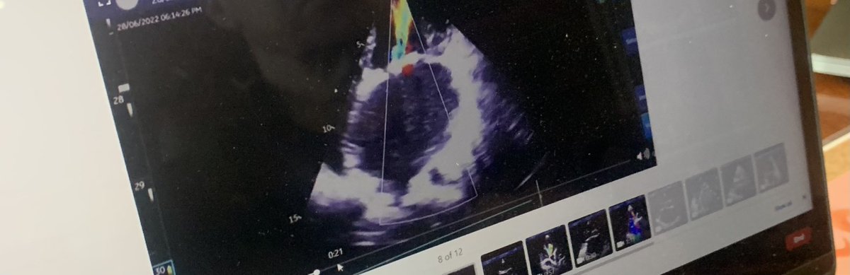 TeamHeartRwanda's tweet photo. Happening Now! Echo conference from #Rwanda hosted by @kfaisalhospital @Musonimaurice1 #rhd @YihanLinMD #JayPal Some lucky young lady will receive cardiac surgery this week! https://t.co/WojqOHJIwJ