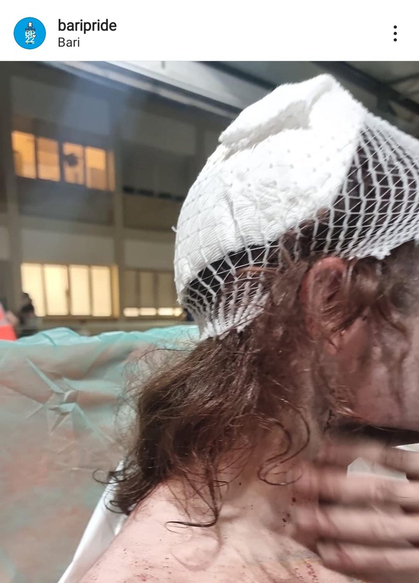 miIIeuniversii's tweet photo. Raga non ignorate perché ciò che è successo ieri a Bari è abbastanza imbarazzante, dei ragazzi hanno insultato e spaccato la testa a un ragazzo. Qui sotto ci sono tutti gli screen di quello che è successo. Non è normale che nel 2022 succedono ancors queste cose.Rt per fare girare https://t.co/6JyfLOJjhL