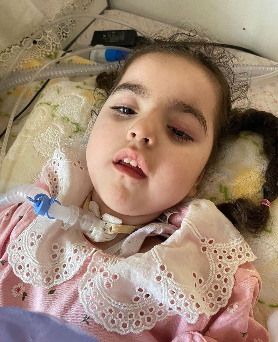 Annesi Ebrar'ı aç yatırıyor yatağına.
Çünkü Ebrar 400 gr alırsa tedavi şansını kaybedecek ve 2 buçuk yıldır verdiği savaşı kaybedecek. Ne olur paylaşın, sesimizi duyurun🙏🏻

#WhatsApp #Weghorst Hazal 
#Tozluyaka #Galatasaray Acun