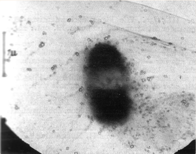 Plasmacellguy's tweet photo. 3/ #Singleplot
F. Twort discovers Bacteriophages, later named so by d'Herelle
https://t.co/yXCL5pbvrb
First image(s) by H. Ruska (1939-40)
https://t.co/hegkxmuyp0
(scale of 1 µm) https://t.co/qO0HYHFtkS