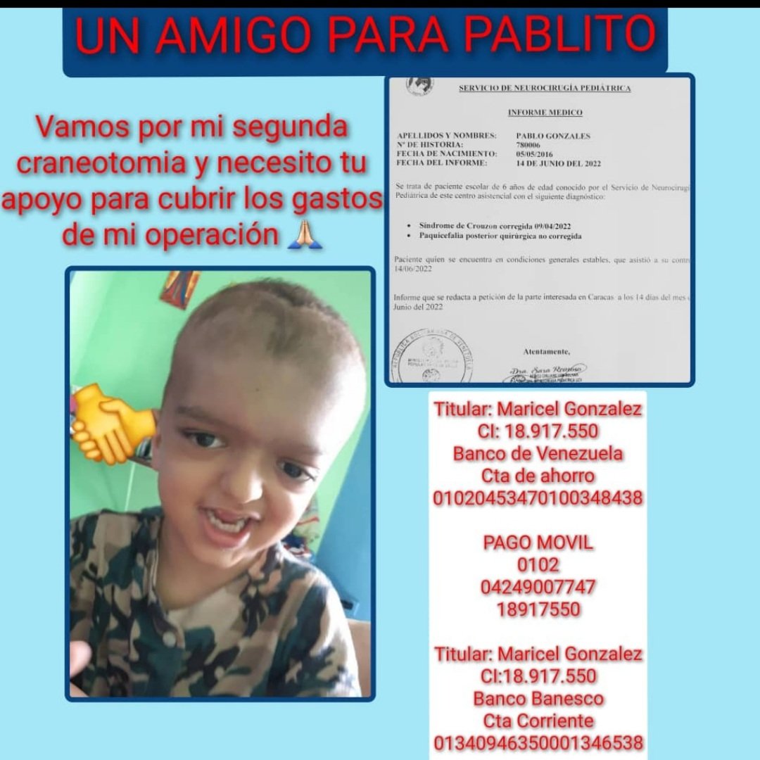Taviogala's tweet photo. 🙏🏻 RT
#Crouzon #Craneosinostosis #Craneotomia #UnaAyudaAPablito
#MáximaMoral https://t.co/WEoahFroWx