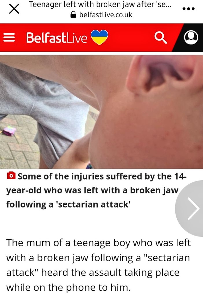 NoSurrender169o's tweet photo. Another young innocent child attacked by sectarian thugs near short strand
#ShortStrand #Belfast #NorthernIreland
That's 2 sectarian attacks on young Protestant boys in the last 24 hours, What are parents teaching their kids? Obviously the hatred being taught to them at home. 🤨 https://t.co/pMQ400uqzA