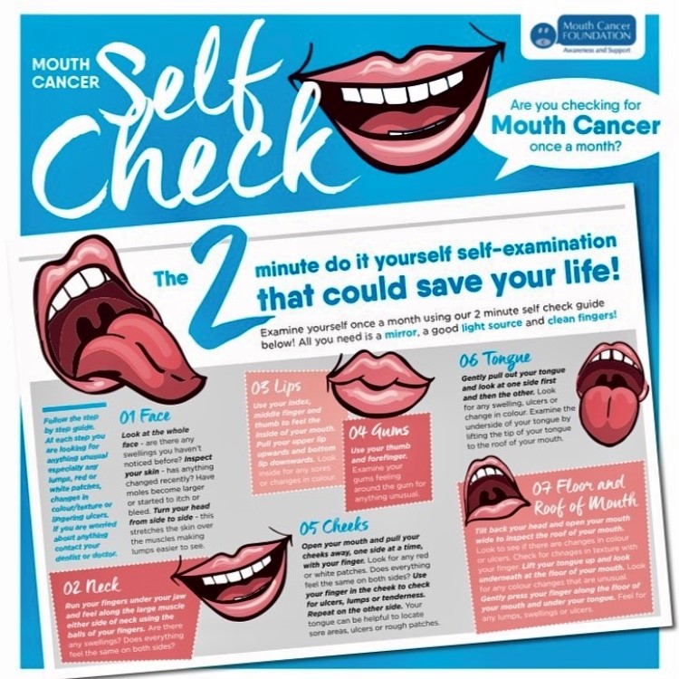 With the sunny weather finally upon us it is still important to regularly self check for mouth cancer! While you are sunbathing this summer, why not take some time to carry out a mouth cancer self-examination. #SelfCheck #SaveLives