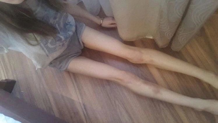 swirlcals's tweet photo. a thread : how to actually get edtwt skinny. ⚔️🧸 bonespo thinspo deathspo https://t.co/UXgOZHevAi