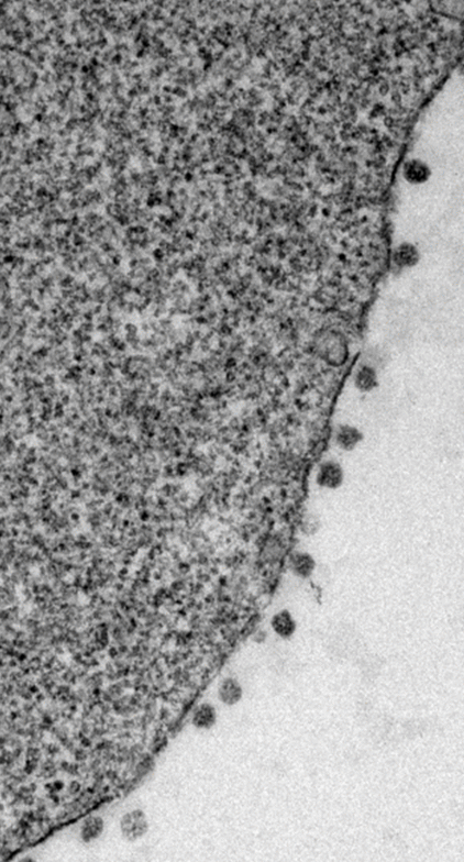 Nolwenn Jouvenet Lab (@lab_jouvenet) on Twitter photo Our work describing the replication of SARS-CoV-2 in several bat cell lines is out <a href="/JVirology/">JVirology Editors</a> 😎 We started from scratch (= a Spanish field trip <a href="/aicher_sophie/">Sophie Aicher</a> and <a href="/jordiserracobo/">Jordi Serra Cobo</a> to collect patagium biopsies) journals.asm.org/doi/10.1128/jv… Our work describing the replication of SARS-CoV-2 in several bat cell lines is out <a href="/JVirology/">JVirology Editors</a> 😎 We started from scratch (= a Spanish field trip <a href="/aicher_sophie/">Sophie Aicher</a> and <a href="/jordiserracobo/">Jordi Serra Cobo</a> to collect patagium biopsies) journals.asm.org/doi/10.1128/jv…
