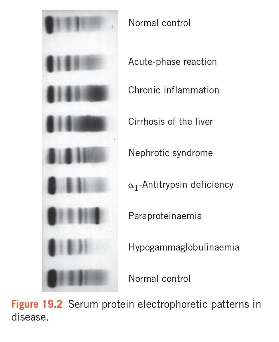 Serum protein electrophoresis test (SPET).. نزلت امس صورة فالبعض طلب