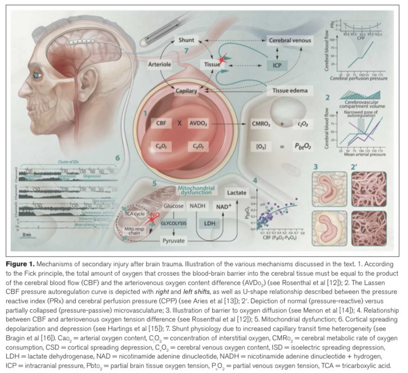 OrlandoRPN's tweet photo. Choque Cerebral - Fisiopatología del Traumatismo Craneoencefálico 🧠🗯

https://t.co/lpRuNojTSk https://t.co/E3b7KV05FJ