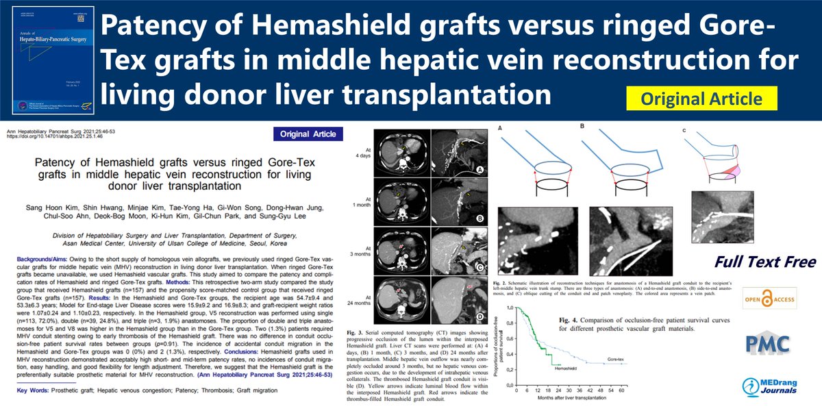 Journal_AHBPS's tweet photo. Patency of Hemashield grafts versus ringed Gore-Tex grafts in middle hepatic vein reconstruction for living donor liver transplantation
🌷https://t.co/zg6ZlnYlEZ
2021 Feb;25(1) Sang Hoon Kim
#Prosthetic_graft #Hepatic_venous_congestion 
#Patency #Thrombosis #Graft_migration https://t.co/nmaYdwZMQl
