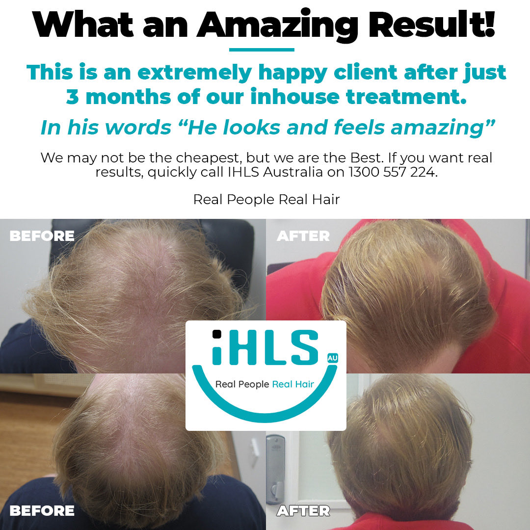 ⁦<a href="/IHLSAU/">Innovative Hair Loss</a>⁩